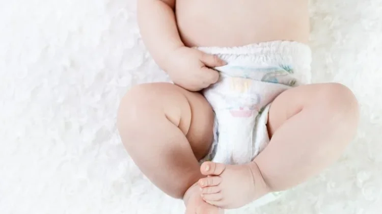 Cara Mengatasi Ruam pada Pantat Bayi, Orang Tua Perlu Kenali Penyebabnya