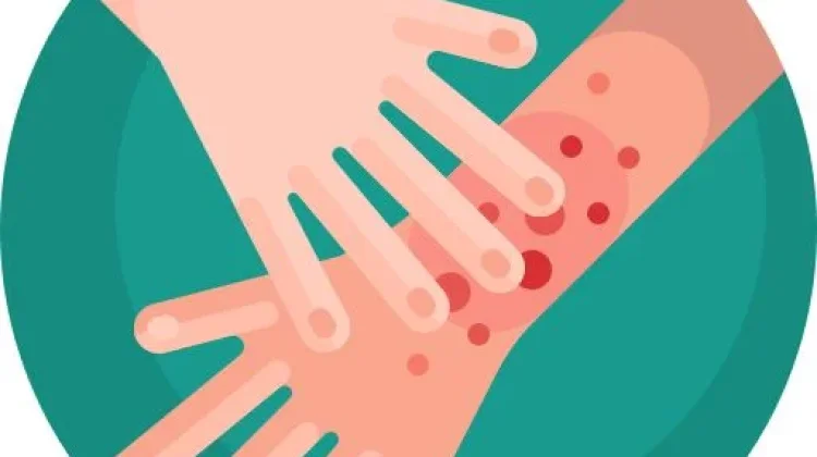 Kasus Flu Singapura Naik, Orang Tua Diimbau Berikan Vaksin HFMD pada Anak