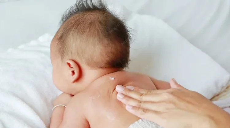 Kulit Bayi Rentan Iritasi, Begini Cara Tepat Memilih Minyak Telon