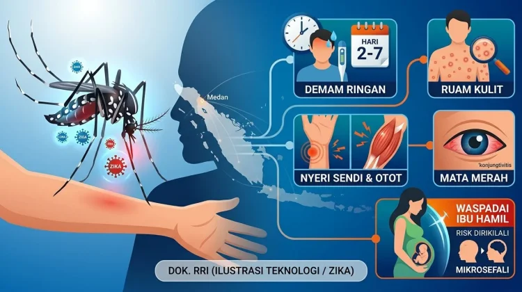Mengenal Virus Zika dan Gejala yang Wajib Diwaspadai