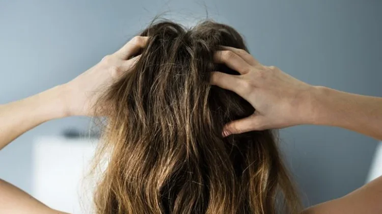 Tidak Hanya Bikin Kulit Halus, Glycolic Acid Punya Potensi untuk Kulit Kepala