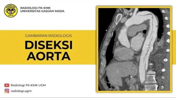 Hari Kesadaran Diseksi Aorta