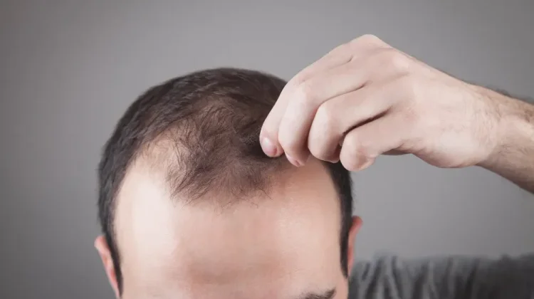 Penyebab Rambut Rontok yang Sering Tidak Disadari