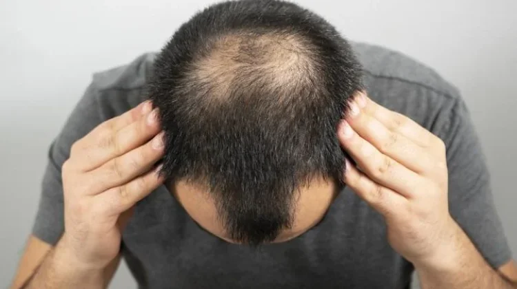 Kebiasaan Sehari Hari yang Bisa Merusak Rambut