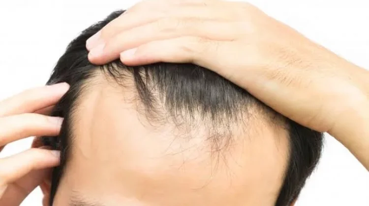 Kebiasaan Sehari Hari yang Bisa Merusak Rambut