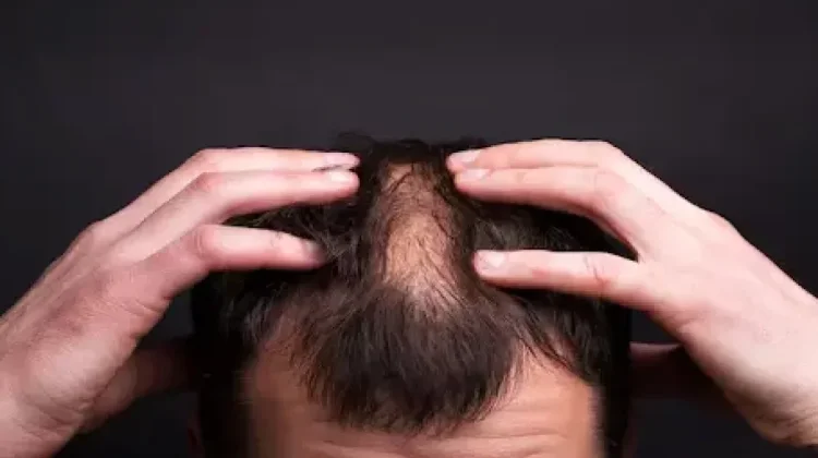 Makanan yang Baik untuk Kesehatan Rambut