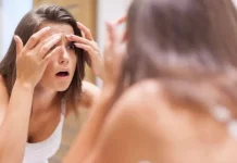 Sering Muncul Jerawat di Bibir? Kenali Penyebab dan Cara Mencegahnya