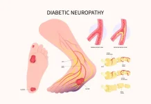Komplikasi Diabetes Bisa Berujung Fatal