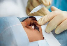 Lasik Bisa Minus Kembali Ini Penjelasannya