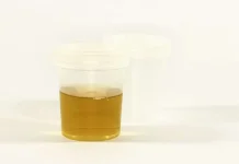 Perlu diketahui Ini Penyebab Kencing Berbusa