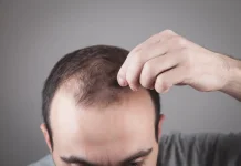 Penyebab Rambut Rontok yang Sering Tidak Disadari