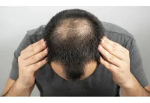 Kebiasaan Sehari Hari yang Bisa Merusak Rambut