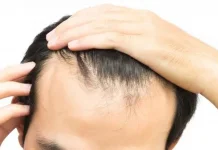 Kebiasaan Sehari Hari yang Bisa Merusak Rambut