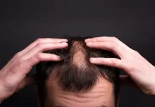 Makanan yang Baik untuk Kesehatan Rambut