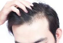 Hubungan Kurang Tidur dengan Kesehatan Rambut