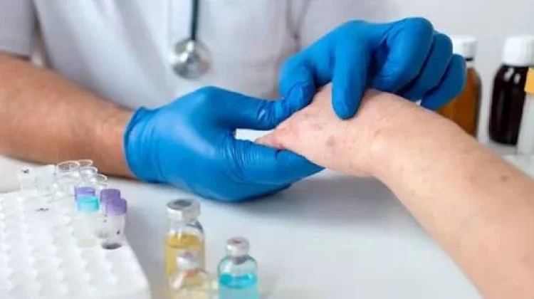 Kemenkes Ajak Masyarakat Hapus Stigma Terhadap Kusta