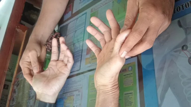 Tes Telapak Tangan, Cara Sederhana Mengenali Kondisi Kesehatan