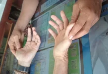 Tes Telapak Tangan, Cara Sederhana Mengenali Kondisi Kesehatan