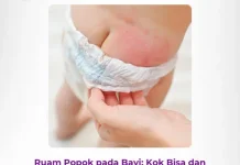 Cara Paling Efektif Menghilangkan Pantat Hitam pada Anak