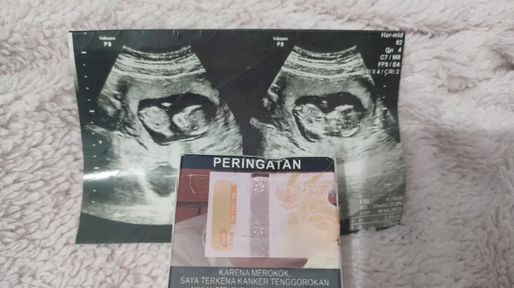 Asap Rokok Berikan Dampak Buruk Bagi Ibu Hamil