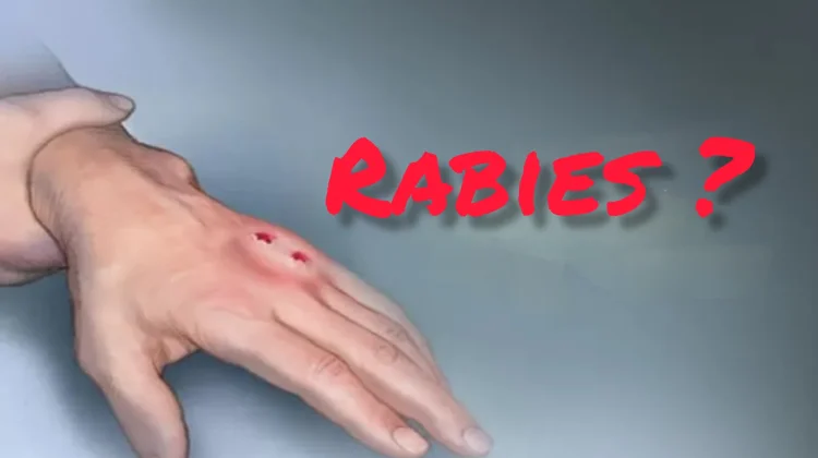 Kasus Gigitan Hewan Penular Rabies di Kaur Tinggi