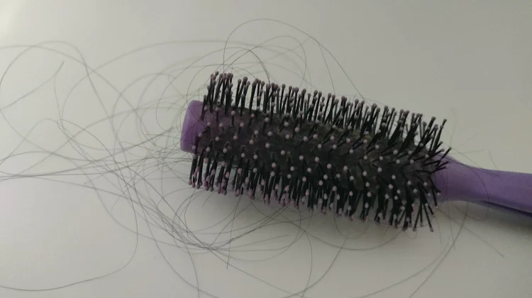 Berikut Cara Mengatasi Rambut Rontok Secara Alami