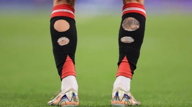 Alasan Kaos Kaki Pemain Bola Sering Dilubangi, ternyata Bukan Gaya