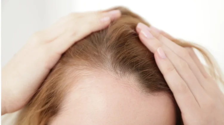 Sering Ikat Rambut Ketat di Balik Hijab? Ini Risikonya