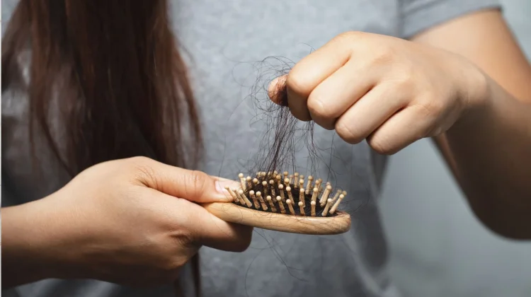 Bukan Cuma Salah Sampo, Stres dan Kurang Vitamin D Bisa Picu Rambut Rontok
