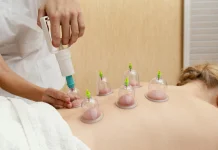 Bahaya Keseringan Bekam