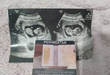 Asap Rokok Berikan Dampak Buruk Bagi Ibu Hamil