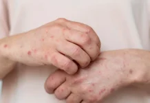 Darah Manis, Apakah Faktor Genetik?