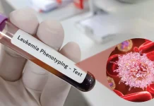 Mengenal Bahaya Penyakit Leukemia Akut