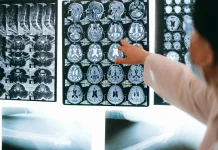 Neuroplastisitas dan Cara Otak Beradaptasi