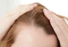 Sering Ikat Rambut Ketat di Balik Hijab? Ini Risikonya