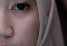 Penyebab Muka Pucat yang Perlu Diketahui
