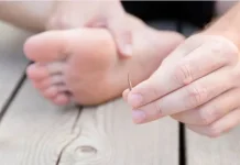 Begini Cara Mengatasi Kaki yang Terkena Tusukan Paku Berkarat