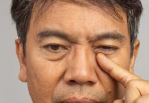 Penyebab Mata Kedutan dan Cara Mengatasinya