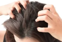 Rambut Gatal dan Berketombe? Kenali Cara Merawat Kulit Kepala
