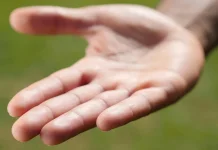 Penyebab Kulit Tangan Menjadi Kering dan Cara Mengatasinya