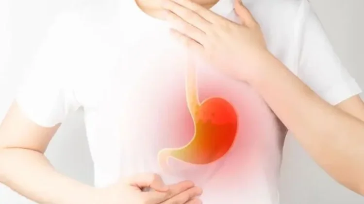 4 Buah yang Harus Dihindari Penderita Asam Lambung