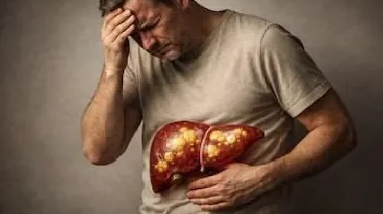 Gejala Sakit Liver yang Sering Tak Disadari Banyak Orang