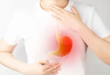 4 Buah yang Harus Dihindari Penderita Asam Lambung