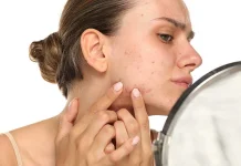 Sering Breakout Padahal Sudah Skincare? Cek Kebiasaan yang Perlu Dihindari