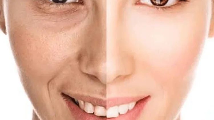 Kulit Sehat dan  Awet Muda di Usia 35+