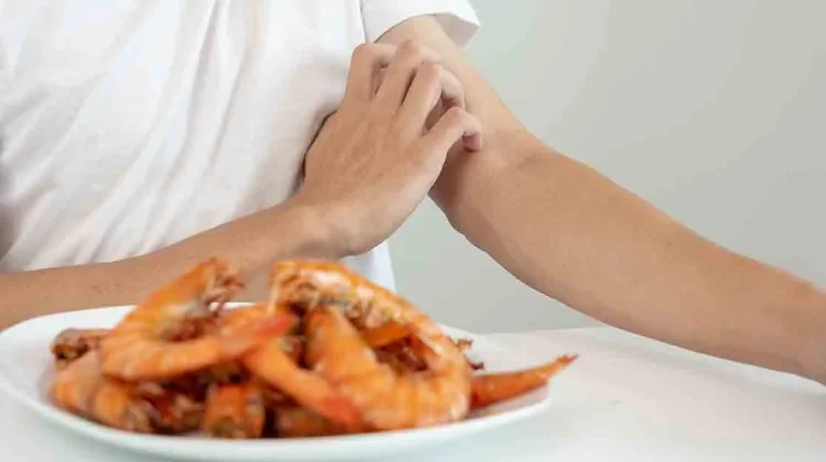 Kenapa Sih Ada yang Alergi Makan Udang? Ini Penjelasannya!