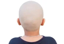 Anak Kepala Botak Gampang Masuk Angin?