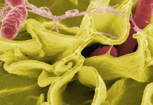 Ancaman Kesehatan Global: Mengenal Wabah Salmonella dan Dampaknya Bagi Tubuh