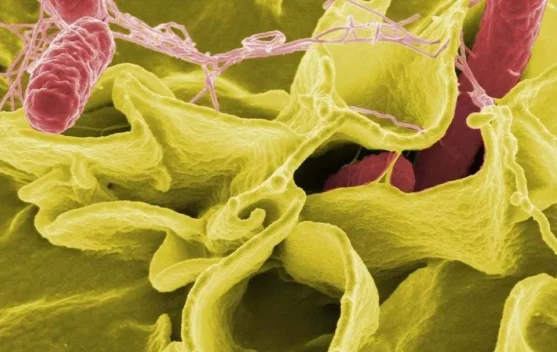 Ancaman Kesehatan Global: Mengenal Wabah Salmonella dan Dampaknya Bagi Tubuh