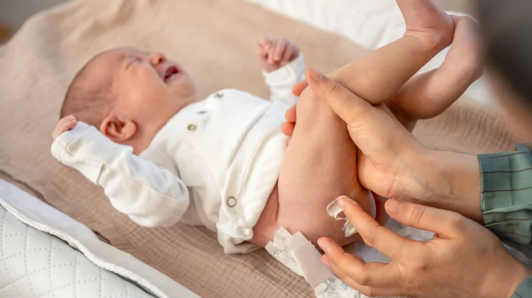Kenali Masalah Kulit Bayi dan Cara Mengatasinya